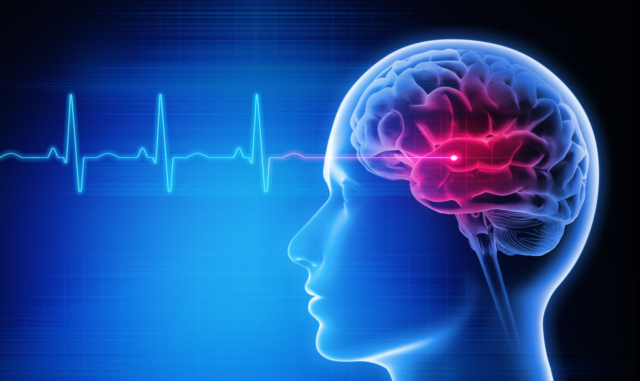 Man with a headache - Brain Stroke - X ray 3D Illustration with blue background